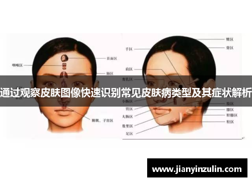 通过观察皮肤图像快速识别常见皮肤病类型及其症状解析 通过观察皮肤图像快速识别常见皮肤病类型及其症状解析