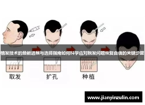 植发技术的最新进展与选择指南如何科学应对脱发问题恢复自信的关键步骤 植发技术的最新进展与选择指南如何科学应对脱发问题恢复自信的关键步骤